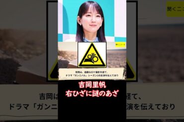 #吉岡里帆 #ディズニーシー 満喫も…アザを心配する声が相次ぐ 「どうしたの」「大丈夫？」#ニュース速報