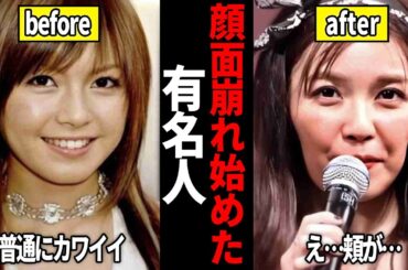 【有益2ch】ヤバすぎ・・・急激に老化した芸能人【芸能人スレ】