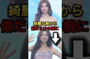 TWICEサナ衣装トラブルで傷だらけになる... #トゥワイス #sana #衣装 #韓国 #shorts #kpop #twice #misamo #ダヒョン #jyp #ナヨン #日産スタジアム