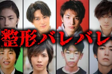 【バレバレ】整形をしている男性芸能人TOP10