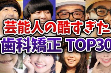 【閲覧注意】歯並び酷すぎ！芸能人の歯科矯正 衝撃ランキングTOP30【ガルちゃんまとめ】