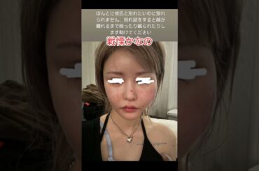 戦慄かなのインスタグラム写真DV被害djまるから#レペゼンフォックス #レペゼン #djまる #戦慄かなの