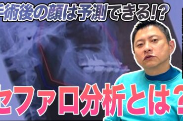 【顎変形症】「手術後の顔が心配...」手術を検討している方にぜひ知って欲しいセファロ分析【鶴木三郎】