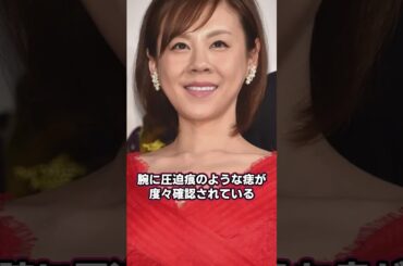高橋真麻がDVで極秘離婚？番組中に映ったアザの真実とは…