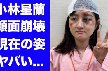 【衝撃】小林星蘭の顔面変形した変わり果てた現在の姿...クズ母のせいで芸能界から消された真相に驚きを隠せない...『名前をなくした女神』で有名な女優の家庭崩壊の実態に言葉を失う...