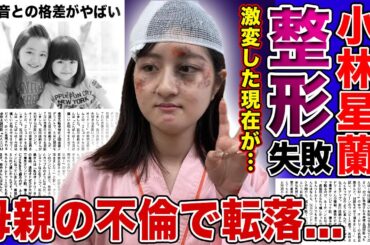 【衝撃】小林星蘭の変わり果てた現在がやばい...不細工になったと言われる現在の顔は整形によるものだった！？子役として活躍した彼女の母親が不倫女だった実態...谷花音との格差に驚きを隠せない！