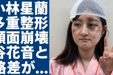 小林星蘭が激変した現在の姿...多重整形で顔面崩壊の真相に言葉を失う...子役として現在も活躍中の彼女が谷花音との格差がヤバい..母親が不倫女と言われる真相に驚きを隠さない...