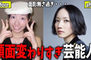 【ガルちゃん芸能】変わりすぎじゃない？！芸能人の整形前画像比較【芸能人スレ】