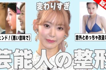 【ガルちゃん芸能】整形だよね？と思う芸能人を紹介【総集編】