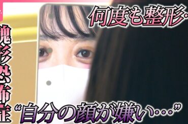 【知ってほしい私のこと】“自分の顔が醜い”と強い不安に襲われ“整形”繰り返す…「醜形恐怖症」に苦しむ女性の思い『every.特集』