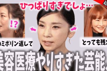 【削除覚悟】あの女優さん噂じゃなくやっぱり…美容医療やりすぎ芸能人　【総集編】　#ガルちゃんまとめ　#有益2ch　#ガルちゃん芸能