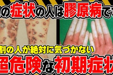 【日本人の○%が感染】知らずに放置すると大後悔する膠原病に関する初期症状とは…？【医師監修】