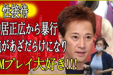 【驚愕】高橋真麻が語る中居正広からの被害の実態…激痩せで頬がこけた女子アナが直面した離婚危機の真相とは？腕に広がるあざの真の理由に一同驚愕！