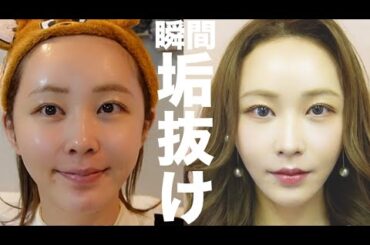 しれっと整形してきましたが