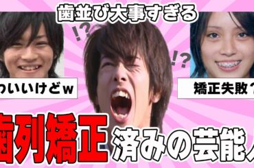 【雑談スレ】芸能人の歯列矯正について【ガルちゃん芸能人】