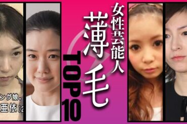 【治療中】意外にも薄毛で悩んでいる女性芸能人TOP10