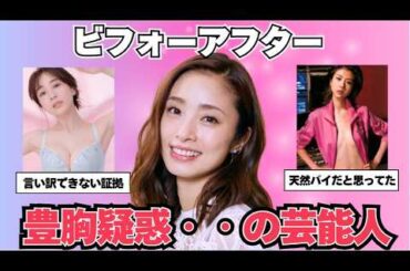 【ガルちゃん芸能】ビフォーアフター、豊胸疑惑の芸能人