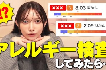 【花粉症】後藤真希がアレルギー検査をした結果!?まさかの結果が、、