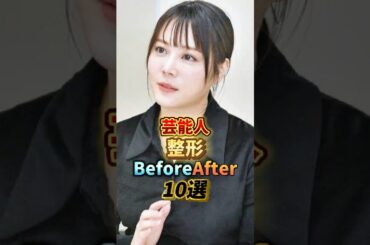 芸能人整形BeforeAfter10選 #youtubeshorts #雑学 #有名人 #芸能人#整形 #美容 #shorts#アイドル