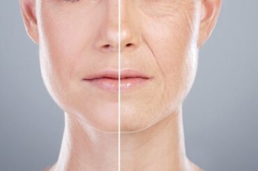 68歳の母を息子医師が美容整形…20歳近く若返り「まるで妹のようになってしまった」と話題に｜Pen Online