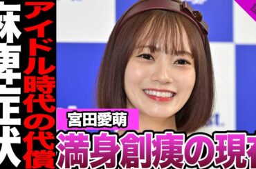 宮田愛萌が明かした満身創痍の現在に言葉を失う…アイドル時代の代償、歩行困難、麻痺症状との闘いに驚きを隠せない！【日向坂46】【アイドル】