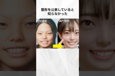 整形を公表していると知らなかった女性芸能人まとめ#shorts #芸能人 #整形