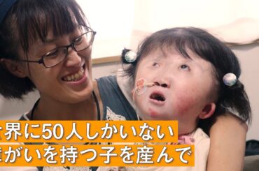 【「こんなかわいい子はいない」】世界的に稀少な染色体異常を持つ子と生きるお母さんの一日 supported by にしたんクリニック