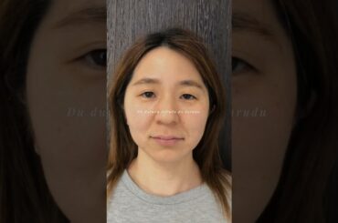 エステをやり続けた結果♥️