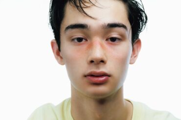 日焼けをしたらアフターケアは何をすべき？ひんやりうるおす夏の“レスキューコスメ” メンズノンノウェブ | MEN'S NON-NO WEB