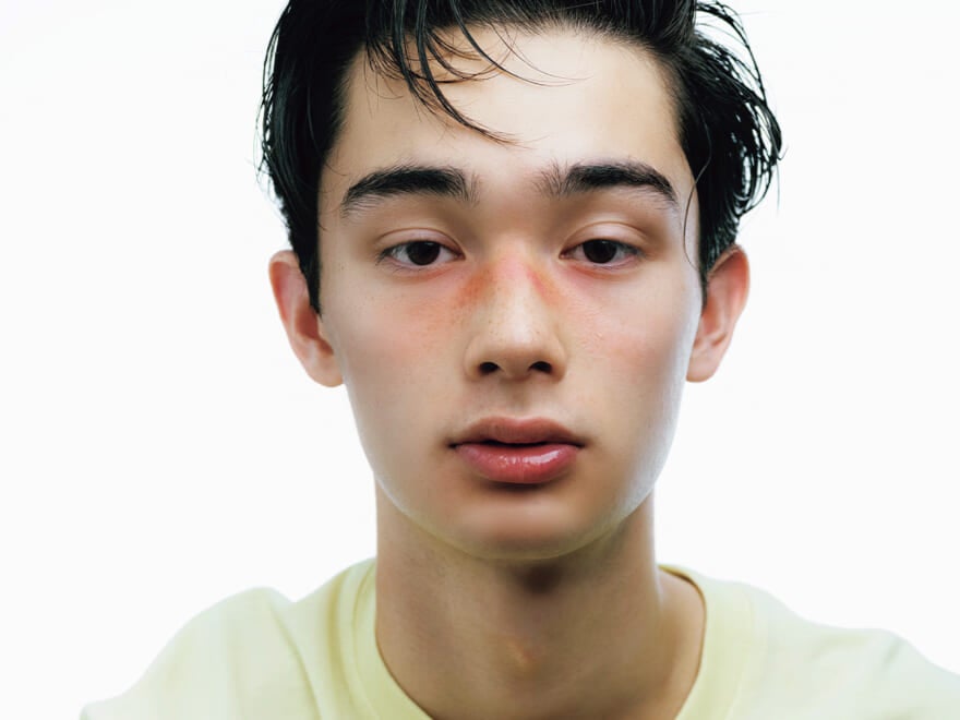 日焼けをしたらアフターケアは何をすべき？ひんやりうるおす夏の“レスキューコスメ”