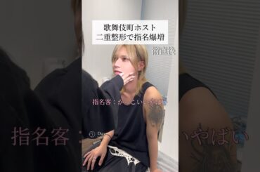 【二重整形】ホストが整形して指名爆増？#shorts