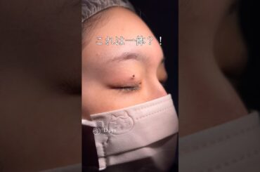 【二重整形/目頭切開】他院修正もお任せください#shorts