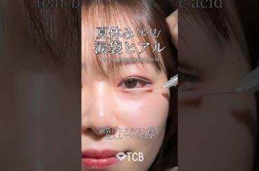 【涙袋ヒアルロン酸】夏休みオススメ🌻涙袋ヒアル#shorts