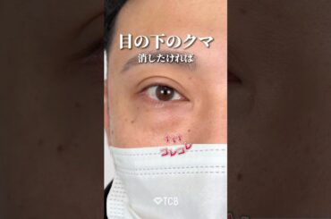 【クマ取り】目の下のクマ消したい人コレやって🐻✨#shorts