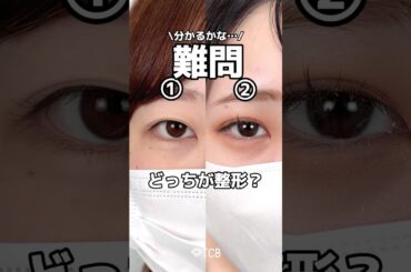 【二重整形】分かるかな？🤔#shorts