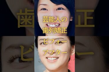 芸能人の歯列矯正ビフォーアフター　#ガルちゃん #芸能人 #歯列矯正