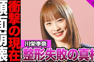 川栄李奈の顔面崩壊に一同絶句....整形失敗により仕事減少で借金地獄の真相がヤバすぎる【アイドル】【乃木坂】