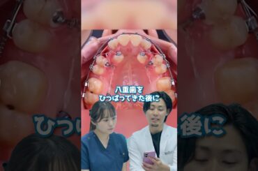 歯並び綺麗にしたいですか？