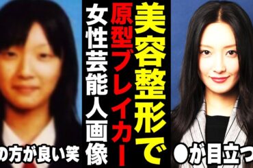 【疑惑】整形発覚！？大変身を遂げた芸能人は誰？美しすぎる16人の噂を徹底検証！整形疑惑とそのリアルとは！？