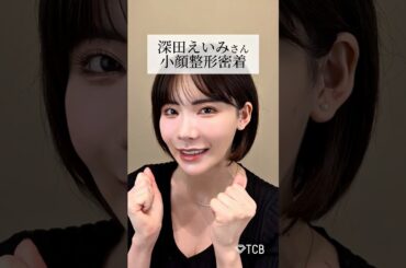 【糸リフト】深田えいみさん小顔整形密着 #shorts