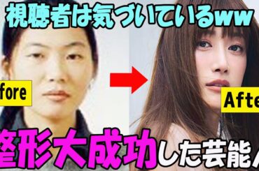【驚きのビフォーアフター】整形成功したと思う芸能人