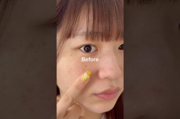 シミ多すぎてオバ肌って言われたから1週間でケアしてみた🔥使ったアイテムはプロフのリンクに貼ってます✨#シミ #美容液 #垢抜け #スキンケア #pr