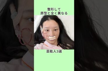 整形して原型と全く異なる芸能人3選  #shorts