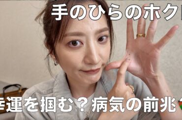 【楽屋雑談】前から気になってた手のホクロ、病院で診てもらった