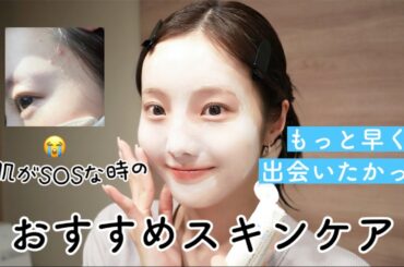 お肌がSOSな時の激推しスキンケア紹介する〜🌤️