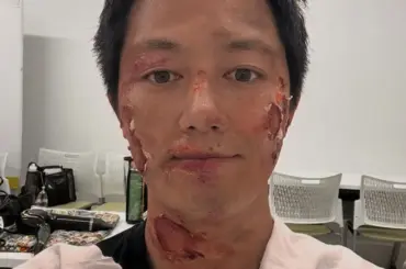 工藤阿須加　顔面大ケガ…リアルすぎる特殊メイクにフォロワーも衝撃「痛々しい」「すごい」 - スポニチ Sponichi Annex 芸能