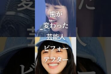 ㊗️100万再生！歯が変わった芸能人ビフォーアフター　#ガルちゃん #芸能人 #歯列矯正