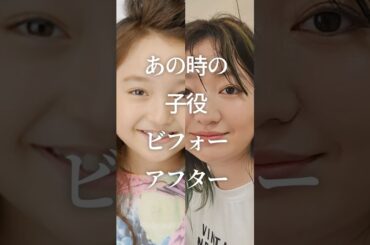 ㊗️100万再生！あの時の子役ビフォーアフター　#ガルちゃん #芸能人 #子役