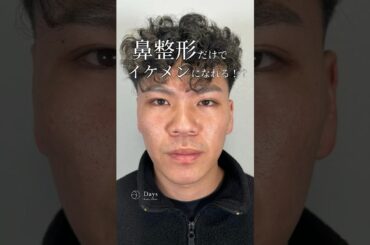 【鼻整形】鼻の形で全顔の印象が変わる！#shorts