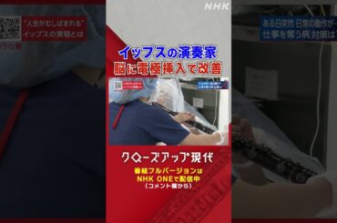 イップスに苦しむオーボエ奏者 脳の手術に密着【クロ現】| NHK | #shorts